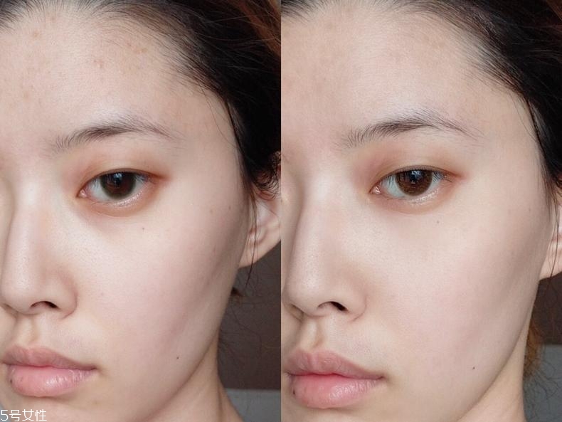 科顏氏淡斑精華真的能祛斑嗎 對斑點沒卵用