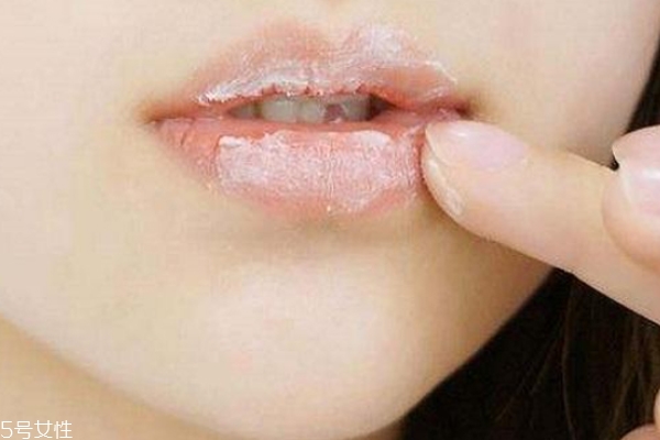 唇部去角質(zhì)的自制方法 這個(gè)妙招省錢又有效 唇部去角質(zhì)的自制方法 這個(gè)妙招省錢又有效