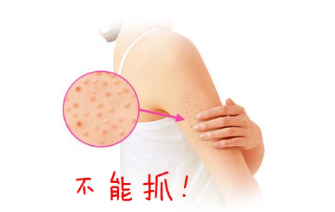 去雞皮膚用什么好 去雞皮膚產(chǎn)品排行榜 去雞皮膚用什么好 去雞皮膚產(chǎn)品排行榜