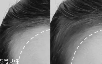 發(fā)際線高適合什么劉海 發(fā)際線高適合的發(fā)型推薦 發(fā)際線高適合什么劉海 發(fā)際線高適合的發(fā)型推薦