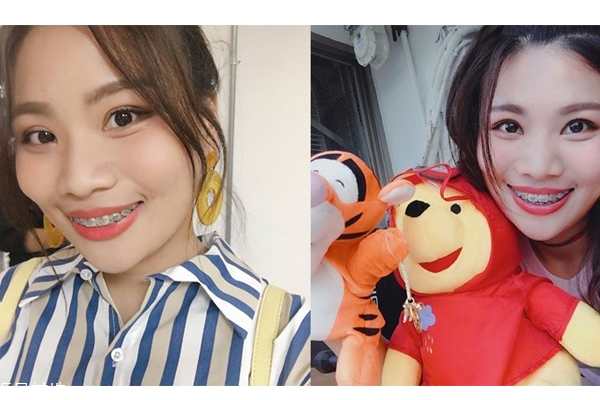 國(guó)字臉怎么瘦臉 4方法和方形臉說掰掰