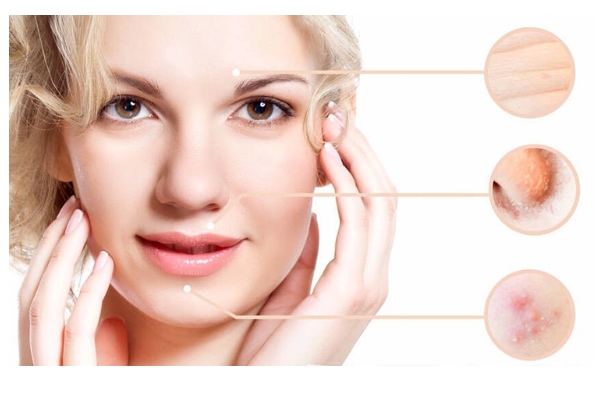 痘痘用什么睡眠面膜好 挑對了擁有光滑肌 痘痘用什么睡眠面膜好 挑對了擁有光滑肌