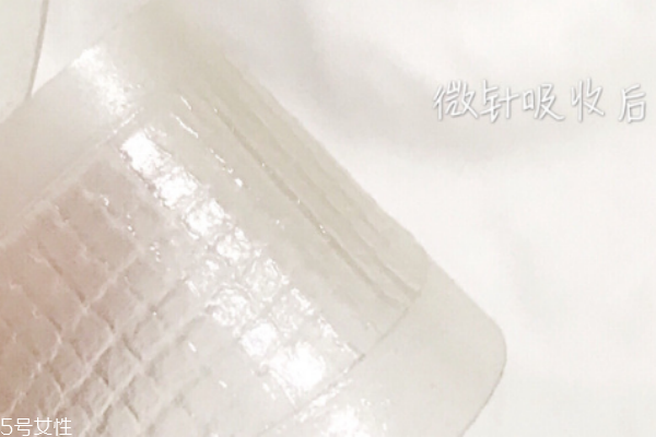 艾派絲微針怎么樣 艾派絲微針眼膜能過夜嗎 艾派絲微針怎么樣 艾派絲微針眼膜能過夜嗎