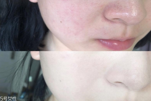 皮膚遮瑕用什么顏色 這3個(gè)色必須要有 皮膚遮瑕用什么顏色 這3個(gè)色必須要有