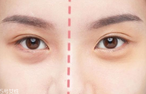 眼下遮瑕卡粉怎么辦 眼下的底妝別上太多 眼下遮瑕卡粉怎么辦 眼下的底妝別上太多