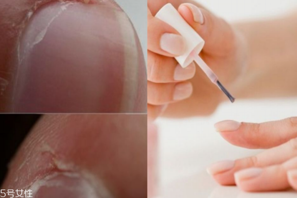 護甲油和指緣油有什么區(qū)別 護甲油能增加指甲厚度