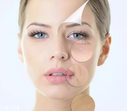 抬頭紋除皺針多久生效 抬頭紋除皺針注意事項 抬頭紋除皺針多久生效 抬頭紋除皺針注意事項
