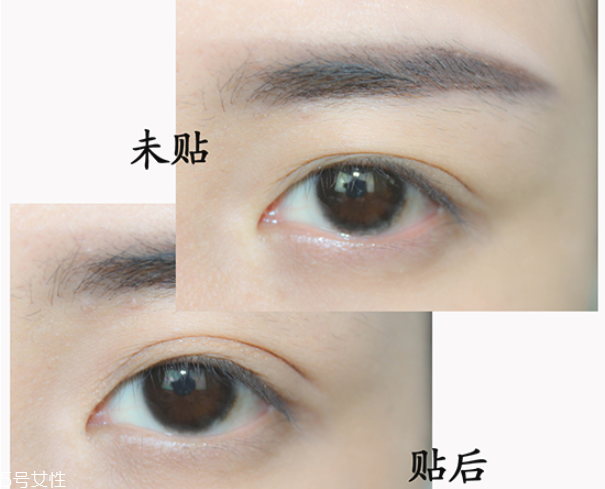 單眼皮怎么貼雙眼皮貼 貼網狀雙眼皮貼的方法