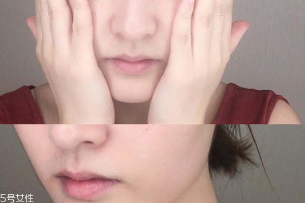 海藍之謎面霜能祛痘嗎 痘肌1周使用報告