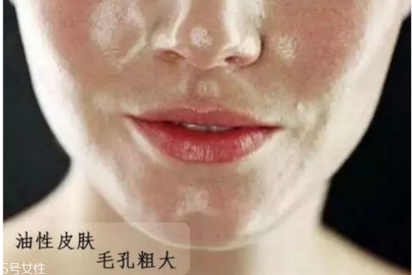 怎么判斷自己什么膚質(zhì) 油皮應該如何護膚