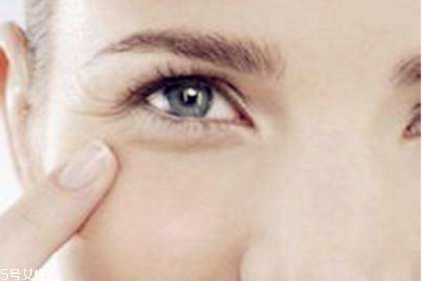 去除魚(yú)尾紋眼袋的妙方 眼霜錯(cuò)誤的涂法