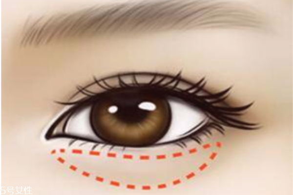 去除魚(yú)尾紋眼袋的妙方 眼霜錯(cuò)誤的涂法