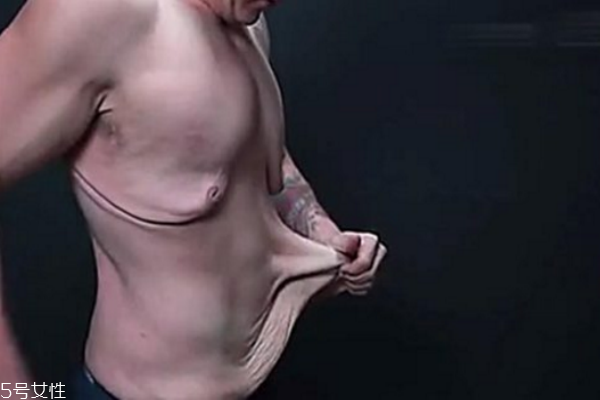 皮膚松弛，你應(yīng)該為肌膚補(bǔ)充營(yíng)養(yǎng)