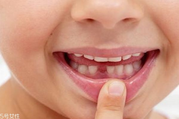 牙縫大怎么修復(fù) 為什么牙縫會越來越大 牙縫大怎么修復(fù) 為什么牙縫會越來越大