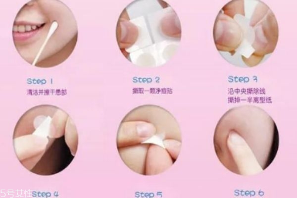 美若康凈痘貼好用嗎 美若康凈痘貼怎么用 美若康凈痘貼好用嗎 美若康凈痘貼怎么用