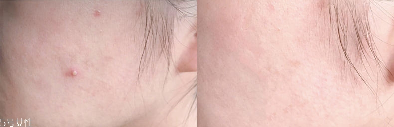 2019醫(yī)美面膜哪個(gè)牌子好 5大熱門醫(yī)美面膜pk