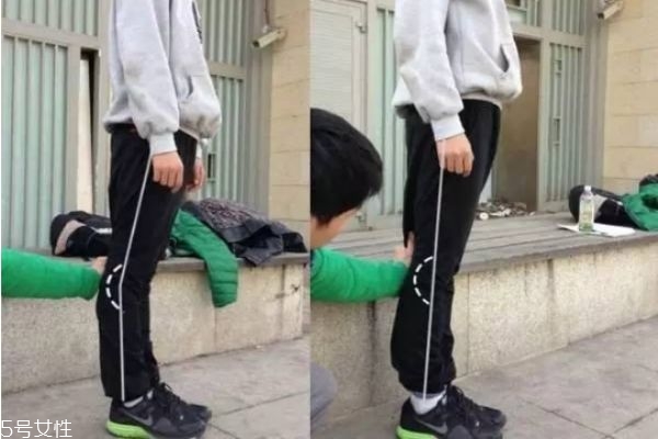 膝蓋超伸怎么矯正 如何正確處理膝超伸 膝蓋超伸怎么矯正 如何正確處理膝超伸