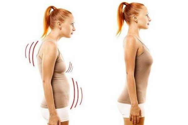 駝背矯正方法