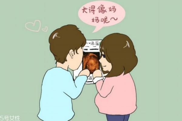 孕婦什么時候做四維彩超最好