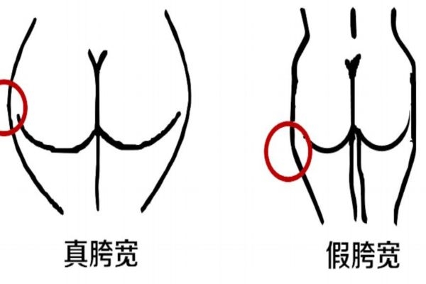 假胯寬是什么意思 自我檢測(cè)假胯寬 假胯寬是什么意思 自我檢測(cè)假胯寬