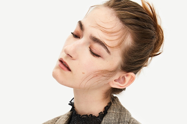 植發(fā)可以用別人的頭發(fā)嗎?植發(fā)用哪里的毛囊? 植發(fā)可以用別人的頭發(fā)嗎?植發(fā)用哪里的毛囊?