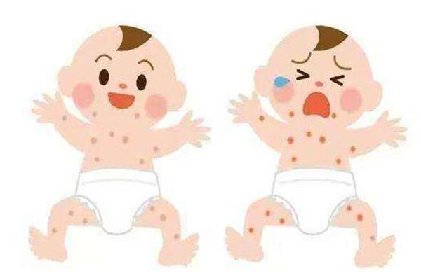 寶寶臉上長(zhǎng)奶癬是怎么回事怎么辦