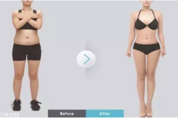 做小腿吸脂手術(shù)疼嗎 小腿吸脂后多久恢復(fù) 做小腿吸脂手術(shù)疼嗎 小腿吸脂后多久恢復(fù)