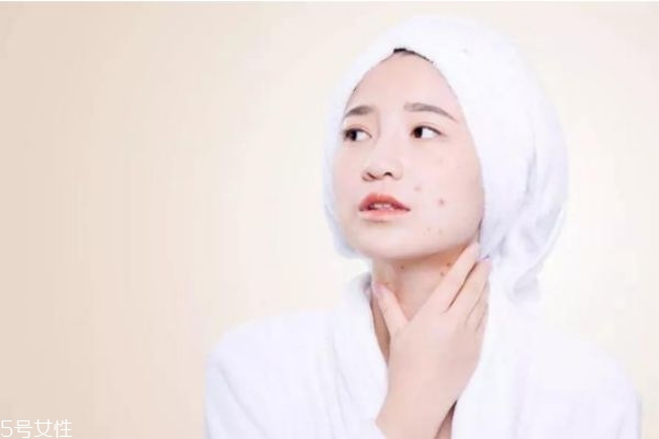 敏感肌膚會自己修復(fù)嗎 如何消滅敏感肌膚 敏感肌膚會自己修復(fù)嗎 如何消滅敏感肌膚