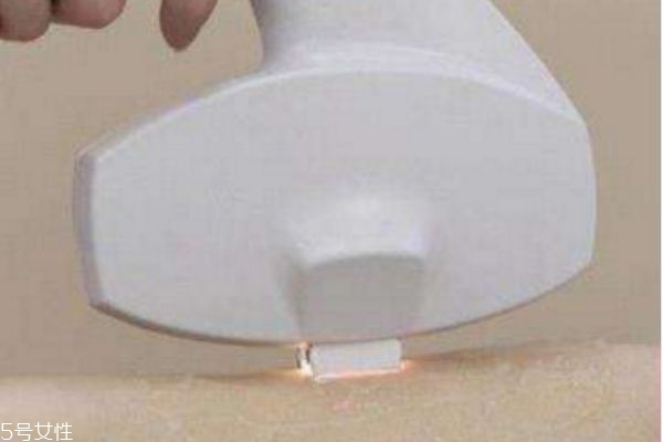 激光脫毛后還會長嗎 激光脫毛能堅持幾年 激光脫毛后還會長嗎 激光脫毛能堅持幾年