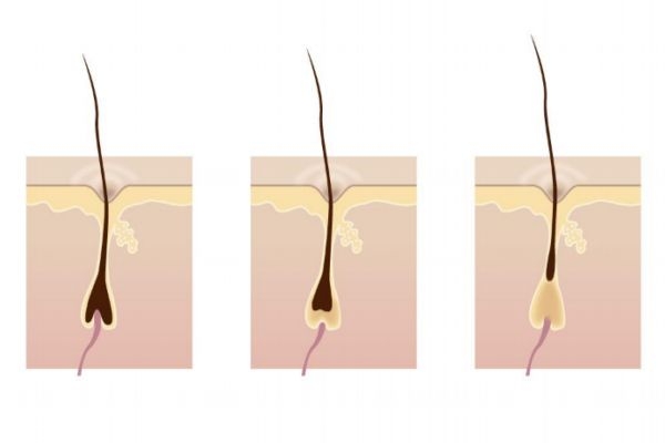 激光脫毛后還會長嗎 激光脫毛能堅持幾年 激光脫毛后還會長嗎 激光脫毛能堅持幾年