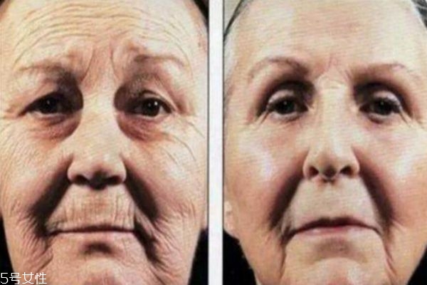 每天堅(jiān)持用防曬的變化 防曬和不防曬真人對比 每天堅(jiān)持用防曬的變化 防曬和不防曬真人對比