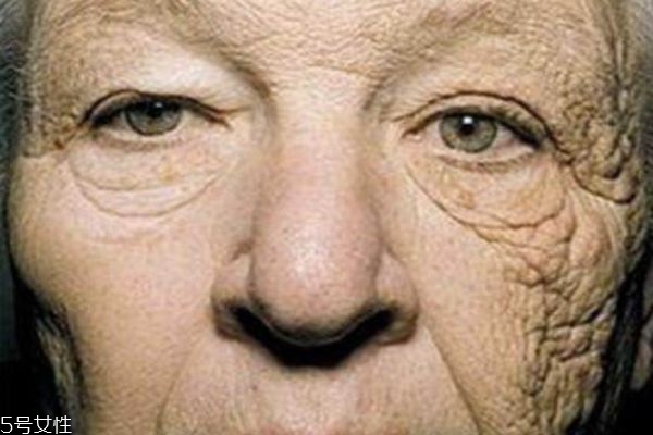 每天堅(jiān)持用防曬的變化 防曬和不防曬真人對比 每天堅(jiān)持用防曬的變化 防曬和不防曬真人對比