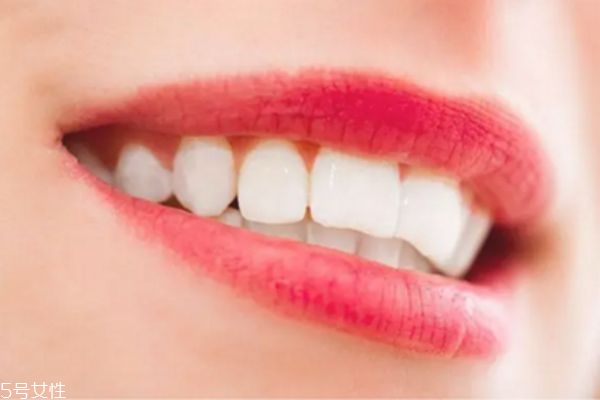 洗牙會(huì)疼痛嗎 洗牙會(huì)不會(huì)傷害牙齒 洗牙會(huì)疼痛嗎 洗牙會(huì)不會(huì)傷害牙齒