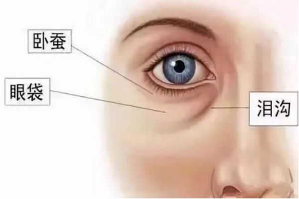 眼袋內切好還是外切好 去眼袋內切和外切區(qū)別