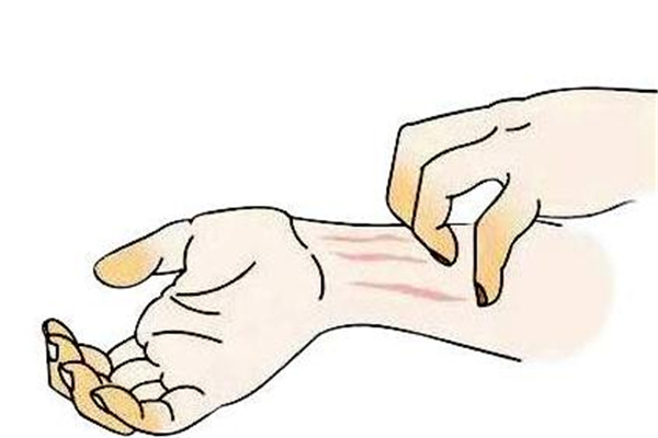 冬季濕疹怎么辦 預(yù)防才是重點(diǎn) 冬季濕疹怎么辦 預(yù)防才是重點(diǎn)