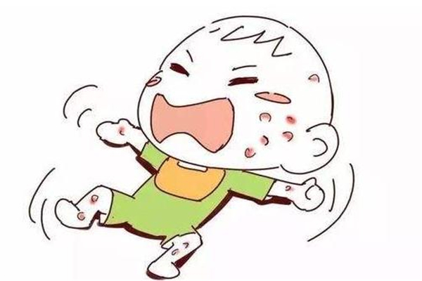 冬季濕疹怎么辦 預(yù)防才是重點(diǎn) 冬季濕疹怎么辦 預(yù)防才是重點(diǎn)