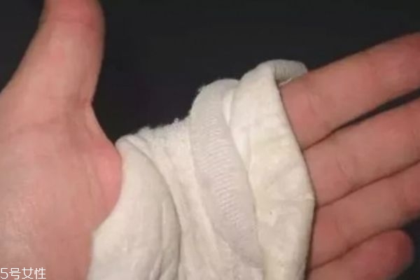 燙傷后的黑印會(huì)消退嗎 需要較長(zhǎng)時(shí)間 燙傷后的黑印會(huì)消退嗎 需要較長(zhǎng)時(shí)間