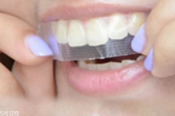 牙貼會(huì)損壞牙齒嗎 會(huì)有一定的傷害 牙貼會(huì)損壞牙齒嗎 會(huì)有一定的傷害