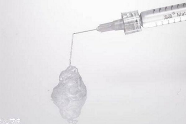 玻尿酸隆鼻外擴(kuò)怎么辦 玻尿酸隆鼻會(huì)變寬嗎 玻尿酸隆鼻外擴(kuò)怎么辦 玻尿酸隆鼻會(huì)變寬嗎