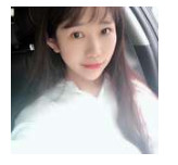 開(kāi)內(nèi)眼角要多久恢復(fù) 依個(gè)人體質(zhì)而定