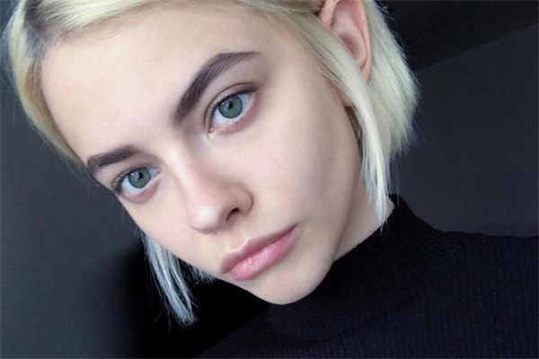 臥蠶打玻尿酸需要幾支 臥蠶打玻尿酸注意事項(xiàng) 臥蠶打玻尿酸需要幾支 臥蠶打玻尿酸注意事項(xiàng)