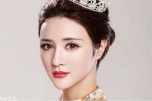 墊下巴多久可以恢復 墊下巴后多久可以吃飯