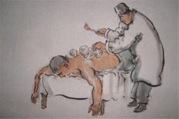 撥火罐后皮膚黑紫的原因是什么 拔火罐皮膚為什么會黑紫 撥火罐后皮膚黑紫的原因是什么 拔火罐皮膚為什么會黑紫