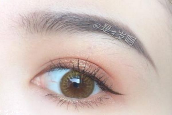 天生腫眼泡怎么辦 腫眼泡能做手術(shù)消除嗎 天生腫眼泡怎么辦 腫眼泡能做手術(shù)消除嗎