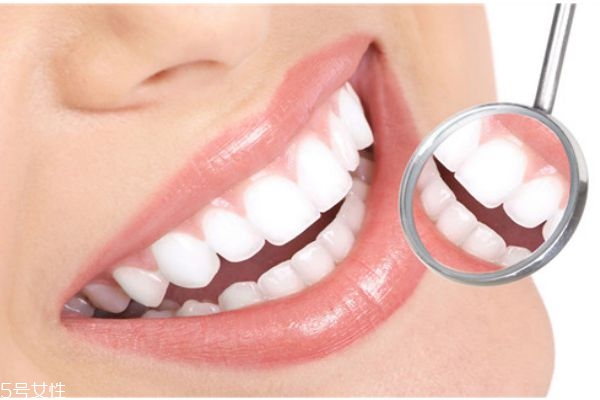 什么是牙結石 牙結石的形成原因