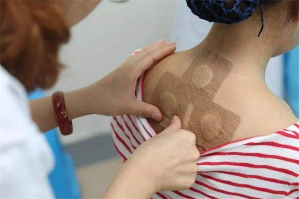 貼三伏貼為什么要忌口 三伏貼要忌口哪些食物 貼三伏貼為什么要忌口 三伏貼要忌口哪些食物