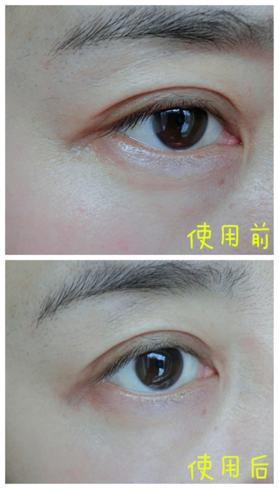 VIIcode夜間氧眼貼抗老效果怎么樣？VIIcode眼膜使用測(cè)評(píng)