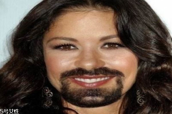 女生為什么長胡子 女生長胡子的原因 女生為什么長胡子 女生長胡子的原因