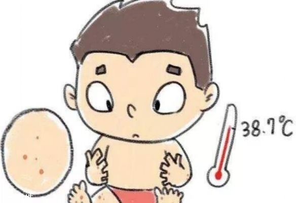 什么是手足口病 為什么會得手足口病 什么是手足口病 為什么會得手足口病