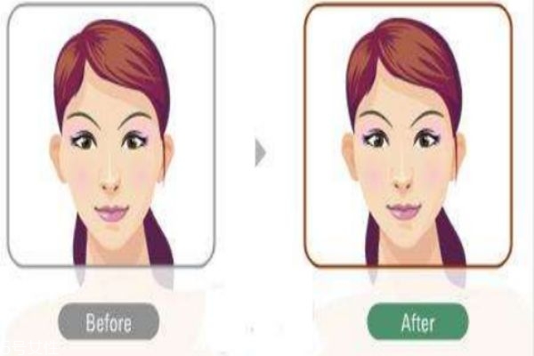 削骨有什么好處呢 削骨有什么壞處呢 削骨有什么好處呢 削骨有什么壞處呢